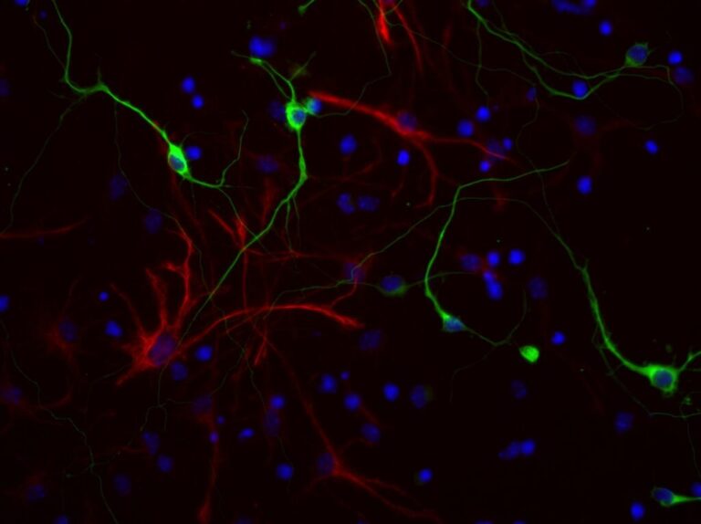 Imágenes de análisis por inmunocitoquímica de células madre neurales  incubadas en condiciones de diferenciación; neuronas en verde y astrocitos en rojo.