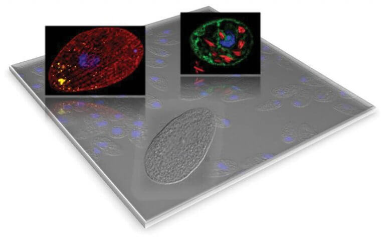 Microscopia confocal mostrando la localización de la desaturasa (verde)
y de fagosomas conteniendo bacterias fluorescentes rojas (derecha);
Tinción con Nile Red, mostrando estructuras membranosas
(rojo) y cuerpos lipídicos o “lipid droplets” en amarillo (izquierda).