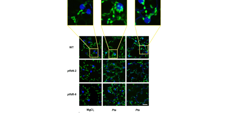 Induction of stromules in the epidermal tissues of tobacco plants during inoculation with Pseudomonas syringae pathovars.